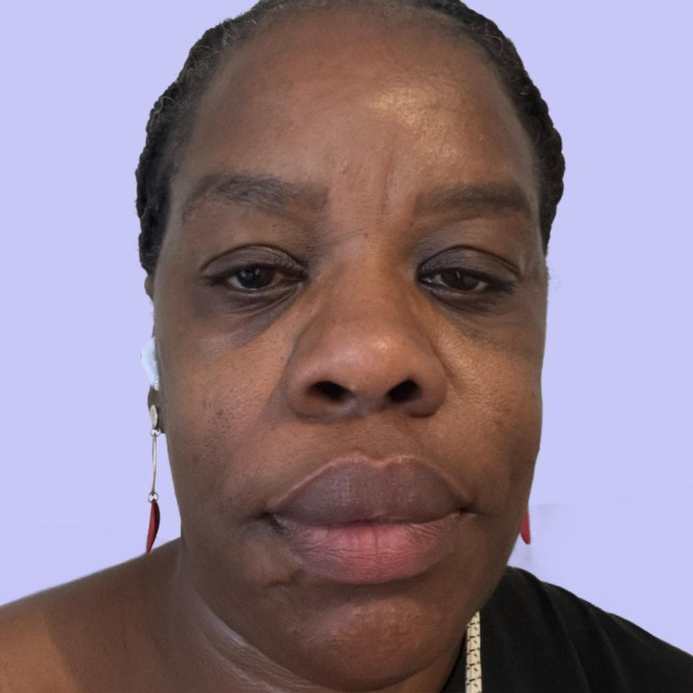 Denise