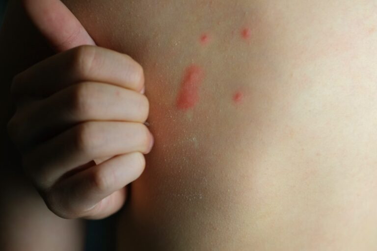 ce qui attire les punaises de lit