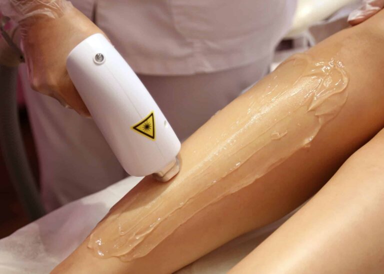 Philips Lumea